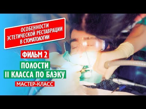 Фильм 2. Полости II класса по Блэку.