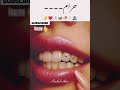 Halal vs Haram in Dental Beauty ChoicesSimple White Teeth vsDecorative Artificial Designs#whiteteeth