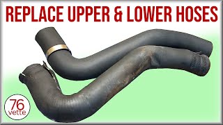 Remove & Install Upper and Lower Radiator Hoses