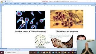 Surgical infections in Arabic 9  (Tetanus, part 1) , by Dr. Wahdan