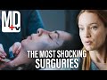 Transplant But It's Just The Surgeries | Transplant | MD TV
