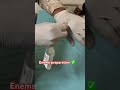 Enema Prepration Nurse Nursing Mbbs Neet Enema Procedure Ytshorts Doctor Pharmacy Gnm