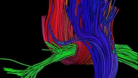 OpenWalnut: LineAO - Improved Three-Dimensional Line Rendering