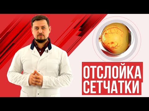 Отслойка сетчатки, симптомы, лечение. Лазерная коагуляция сетчатки.