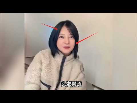 赵薇近照曝光震惊全网！49岁面容大变、婚姻破裂，昔日顶流如今落魄无人问津 | 赵薇近照、全面封杀、医美后遗症、离婚风波、还珠格格、劣迹艺人
