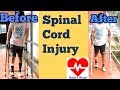 spinal cord injury walking with elbow crutches