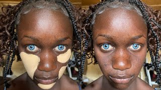 Viral 💣👉😱🔥Makeup Transformation 😳 Cirurgia Plastica 💉💉😱 Makeup Tutorial