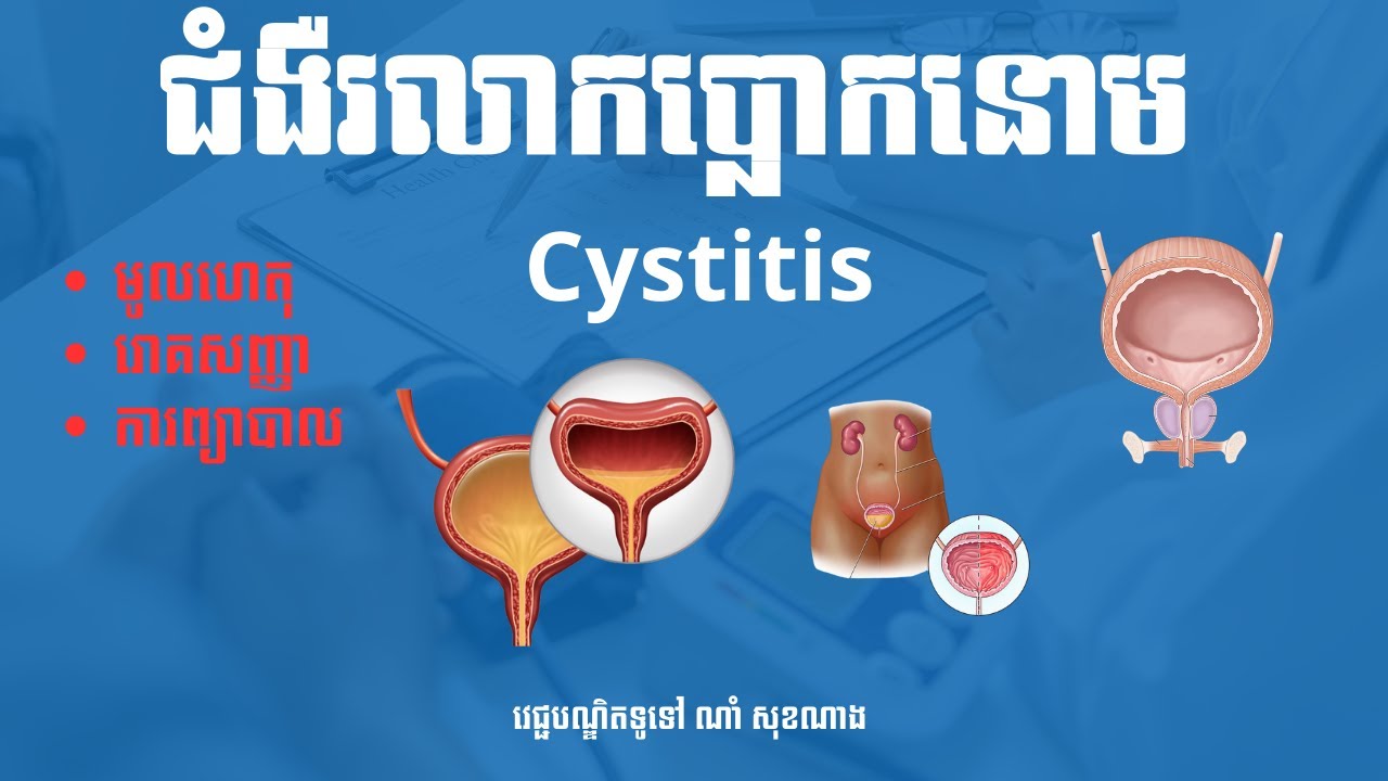 រលាកប្លោកនោម Cystitis និងការព្យាបាល