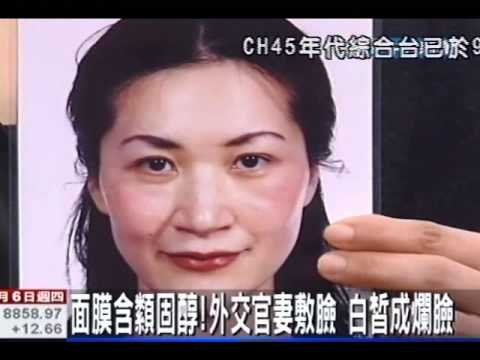面膜含類固醇！外交官妻敷臉 白皙變爛臉
