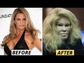 20 Celebrity Plastic Surgery Disasters