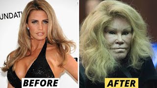 20 Celebrity Plastic Surgery Disasters