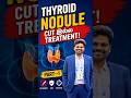Thyroid Nodule Explained | Cancer ஆ? Surgery தேவையா? | Part-1