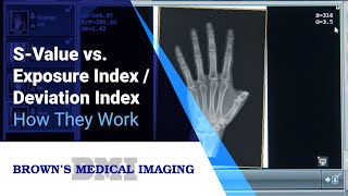 How-to Understand S-Value vs. Exposure Index / Deviation Index In Your Radiographic Images