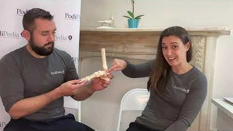 Posterior Tibial Tendon Dysfunction (Adult Acquired Flat Foot)