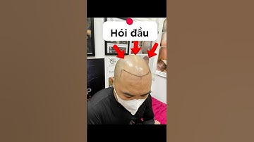 Xăm chân tóc chữa hói cho em trai #cấytóc #hóiđầu #cấytóc #xămchântóc