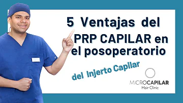 ¿Acelera el PRP los resultados del trasplante capilar?