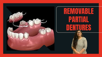 Removable Partial Dentures - An Overview | Indications | Types | Components | Dr. Rashmi Singh