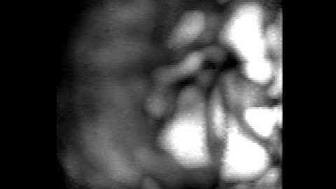 Composite Laminate with Impact Damage