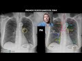 anatomia radiologica-TORAX