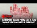 Brote de virus mano, pie y boca en Lambayeque
