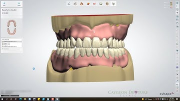 Complete Denture Design