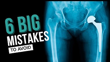 Don’t Do This After Hip Surgery (Or Risk Dislocation!)
