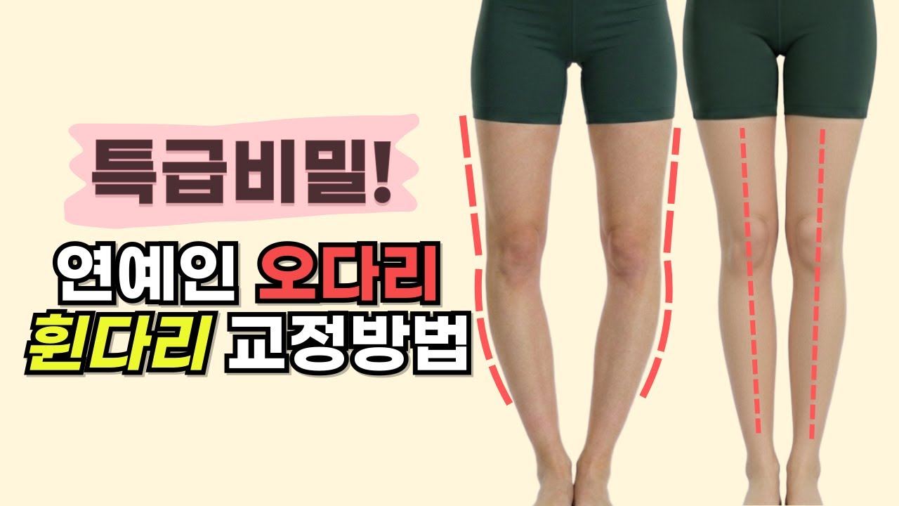 특급 비밀! 연예인 오다리,영업 비밀인데 알려드릴게요.11자 다리 되는법. 휜다리, 오다리,다리교정