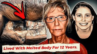 The Girl Who Was Killed By Being Melted Into Couch..
