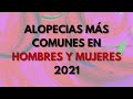ALOPECIAS MÁS COMUNES EN LA CONSULTA DE UN TRICÓLOGO // HOMBRE Y MUJER // 2021