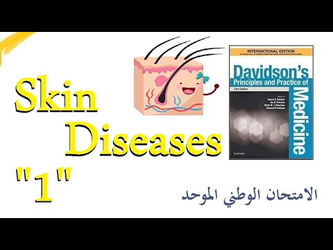 الأمراض الجلدية "1" الصداف | دافيدسون بالعربي | Psoriasis
