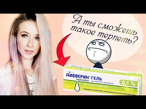 ДИФФЕРИН! ЛЕЧЕНИЕ АКНЕ! Прыщи, проблемная кожа!