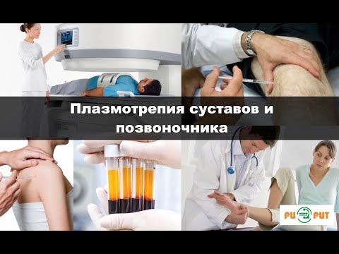 Плазмотерапия позвоночника и суставов в МЦ РИОРИТ СПб