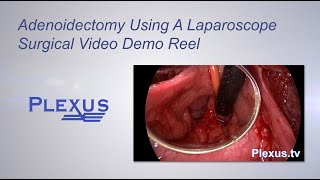 Adenoidectomy Surgical Video