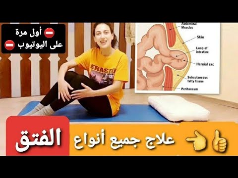 علاج جميع أنواع الفتق 👈 فتق الحجاب الحاجز | فتق شرسوفي | الفتق الإربي | فتق فخذي  #khtisara_channel