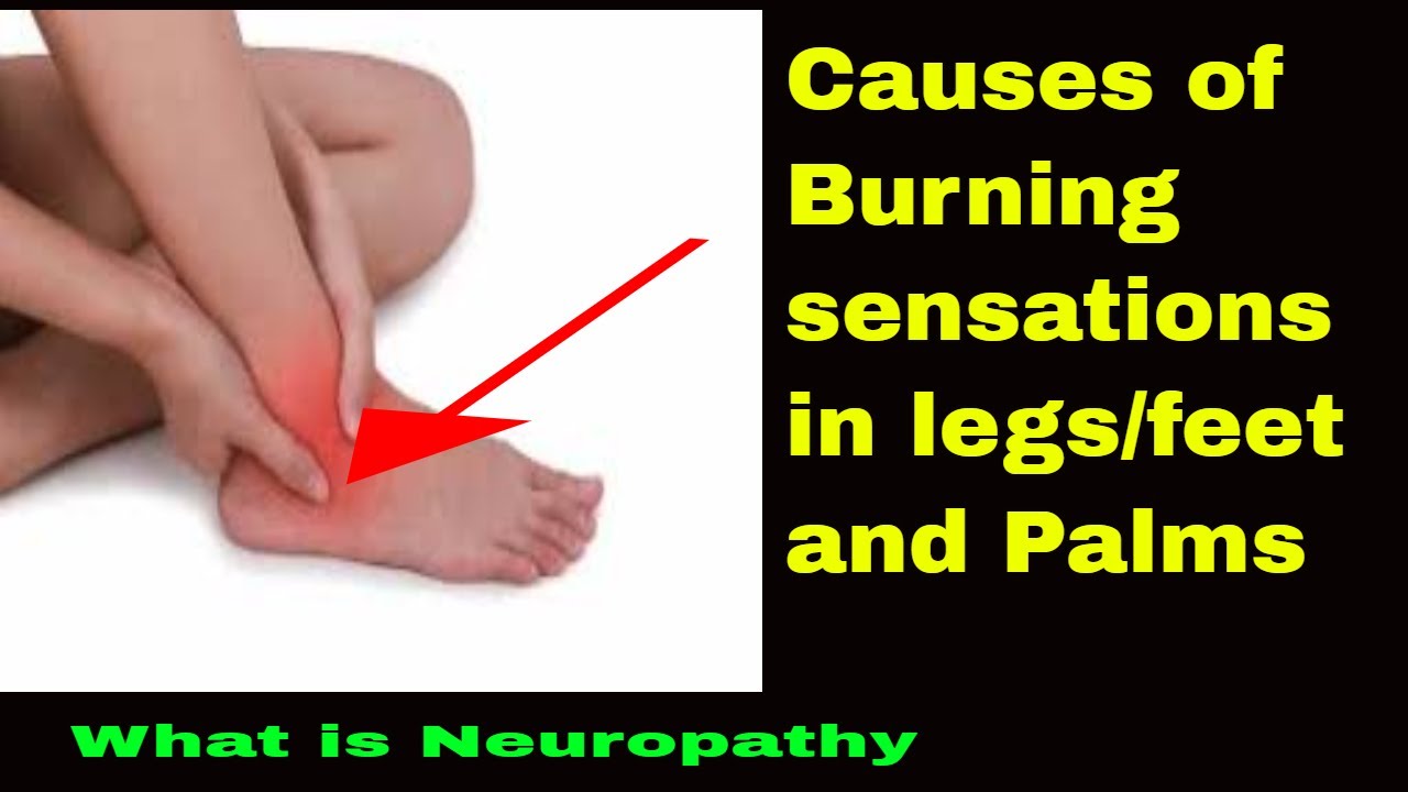 burning sensation in feet and palm [Causes] YouTube