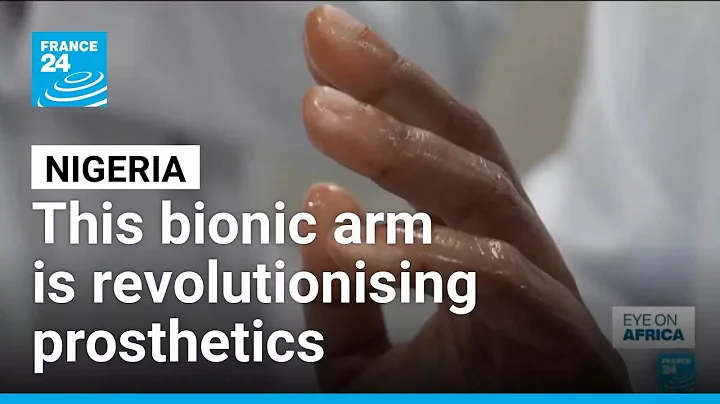 Nigerian firm revolutionises the world of prosthetics with bionic arms • FRANCE 24 English