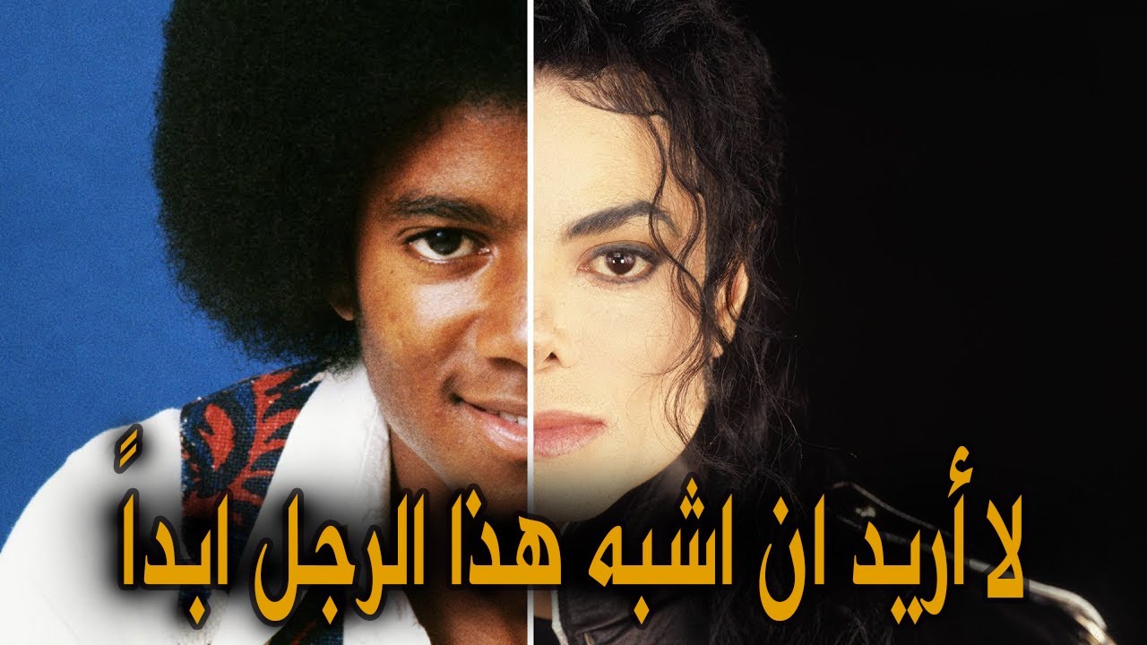 لماذا أجرى مايكل جاكسون 100 عملية تجميل ؟ | السبب الحقيقي