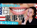 話しちゃいます！アメリカ人の歯事情｜Let's Talk About American Teeth!