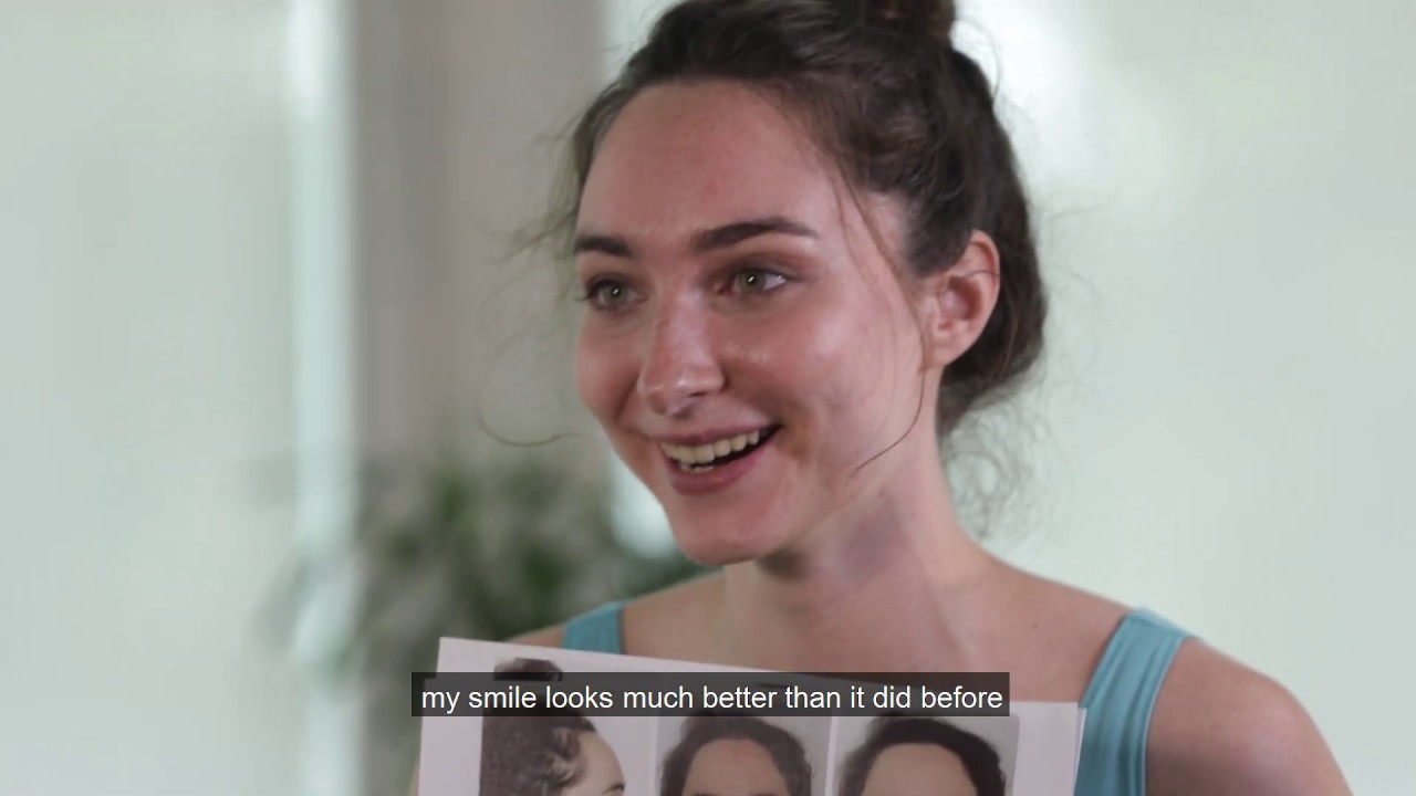 Smiling after a Bicycle Accident