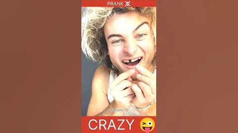 TOPPER GUILD LOSES TOOTH PRANK - #Shorts