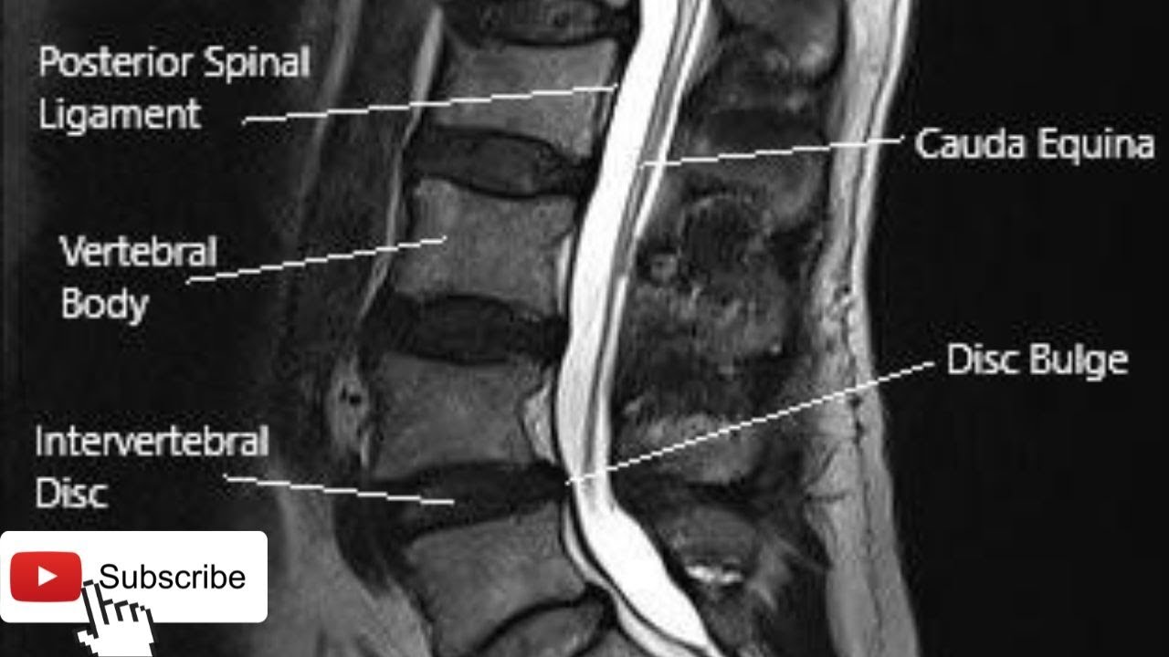 Chiropractic Treatment Of Neck Back Pain Dr JP YouTube chiropractic-treatment-of-neck-back-pain-dr-jp-youtube