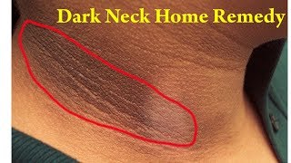 How To Get Rid Of Dark Neck Fast And Easy Brown Skin Around Neck Dark Neck Home Remedy