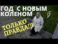 Вся правда об эндопротезировании кооленного сустава и последствиях. Почти год с момента операции.