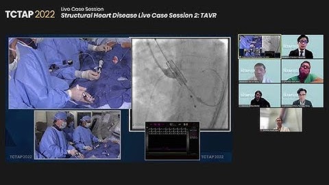 [TCTAP 2022] Structural Heart Disease Live Case Session 2: TAVR