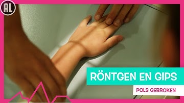 AMBER HEEFT HAAR POLS GEBROKEN - TOPDOKS SEH