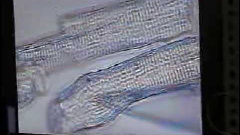 71 - Cellular death.avi