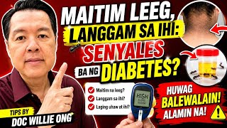 Maitim Leeg, Langgam sa Ihi: Senyales ba ng Diabetes? - Tips by Doc Willie Ong