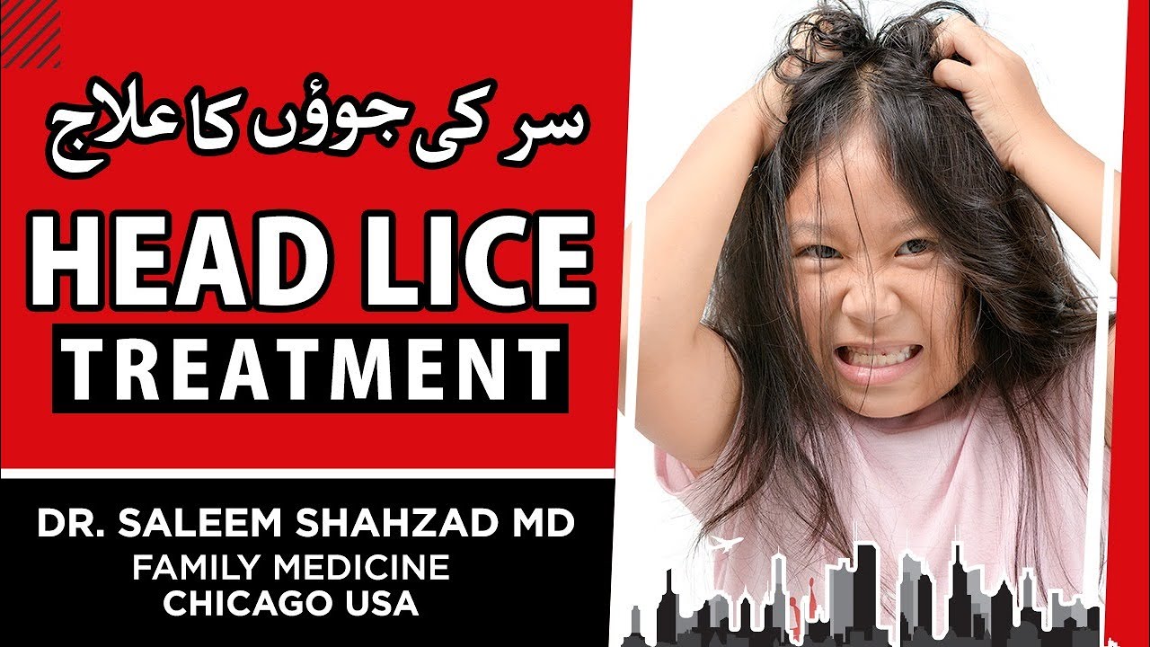 Head Lice Treatment Sir Ki Joaoon Ka Elaaj In Urdu Hindi Dr Saleem