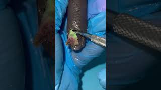 Nail Replacement Surgery 😱🤢💅🏼 (Beauty Is Pain)