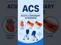 acs explanation #acs #doctor #nursing #explore #education #viral #youtubeshorts #medicalstudent